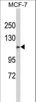 CFAP47 Antibody (aa628-657)