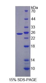 Mouse LDLR / LDL Receptor Protein (Recombinant His-T7, N-terminus)