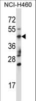 TRIM15 Antibody (aa247-276)