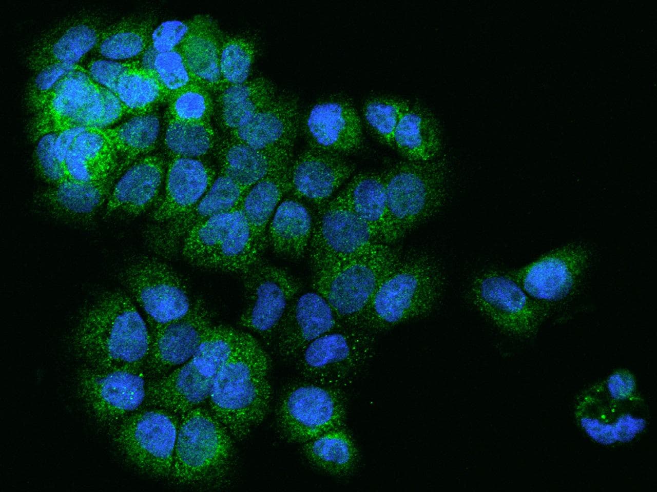 NUBPL Antibody