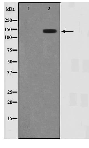 Polyclonal Rabbit anti-Human HDAC6 Antibody (IHC, WB)