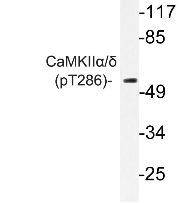 CaMKII Alpha+Delta Antibody (phospho-Thr286)