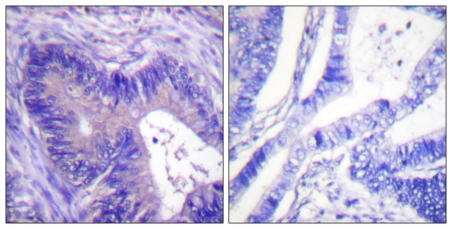 ACLY / ATP Citrate Lyase Antibody (phospho-Ser454)
