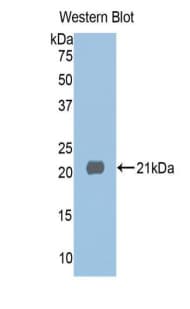 HDAC6 Antibody (aa1038-1204, Biotin)