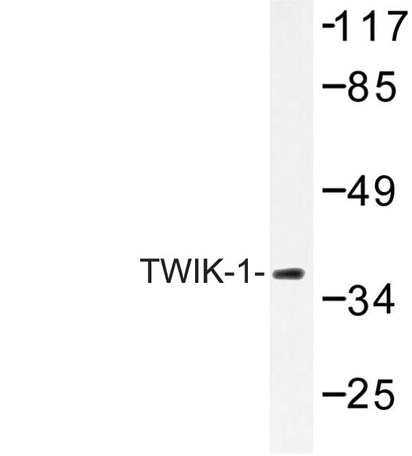 TWIK1 / KCNK1 Antibody (Val322)
