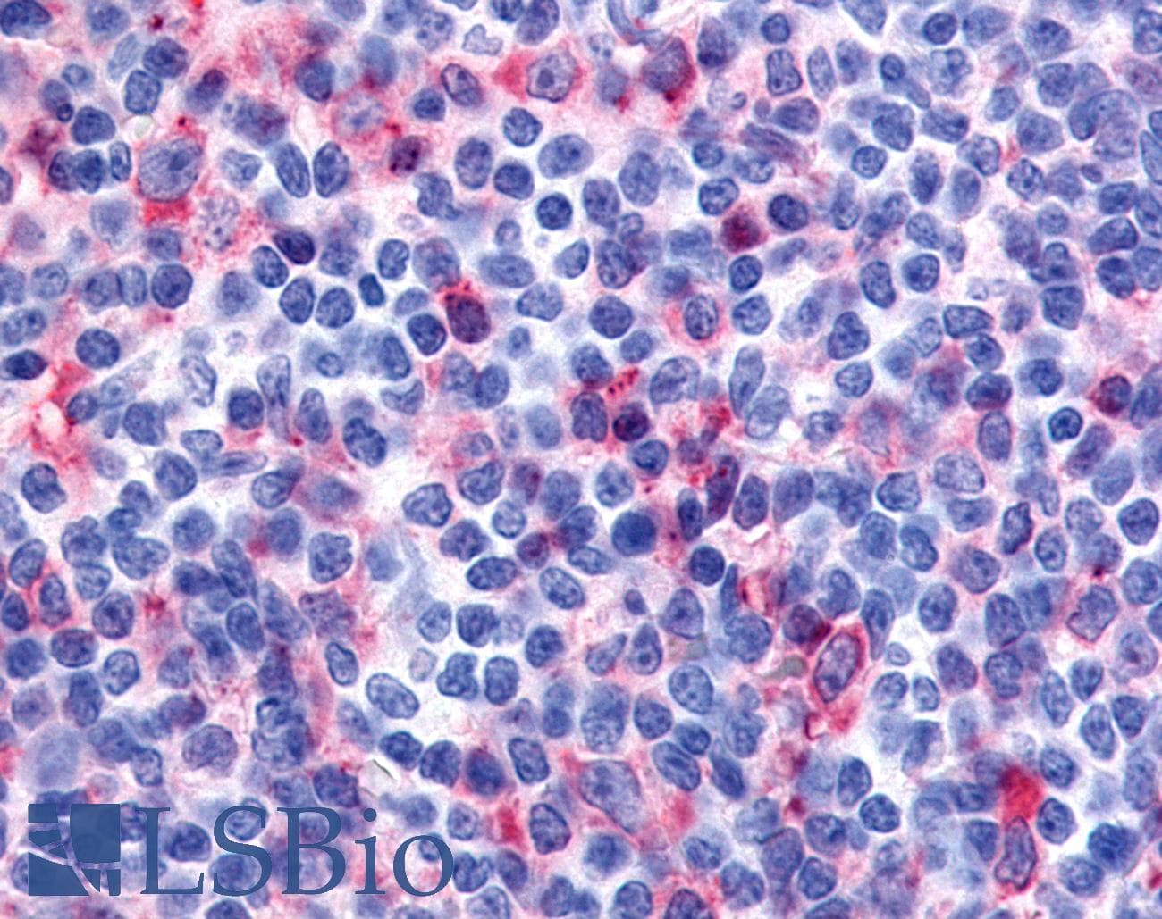 IHC-plus™ Polyclonal Rabbit anti-Human CD135 / FLT3 Antibody (N-Terminus, IHC)