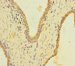 KRT40 / Hair Keratin KA36 Antibody
