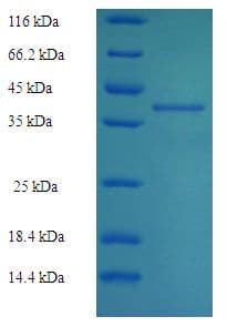 Human GSTA4 Protein (Recombinant His-SUMO)