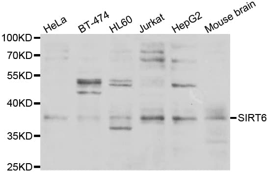 SIRT6 / Sirtuin 6 Antibody
