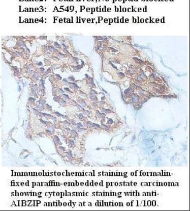 CREB3L4 / AIBZIP Antibody (C-Terminus)