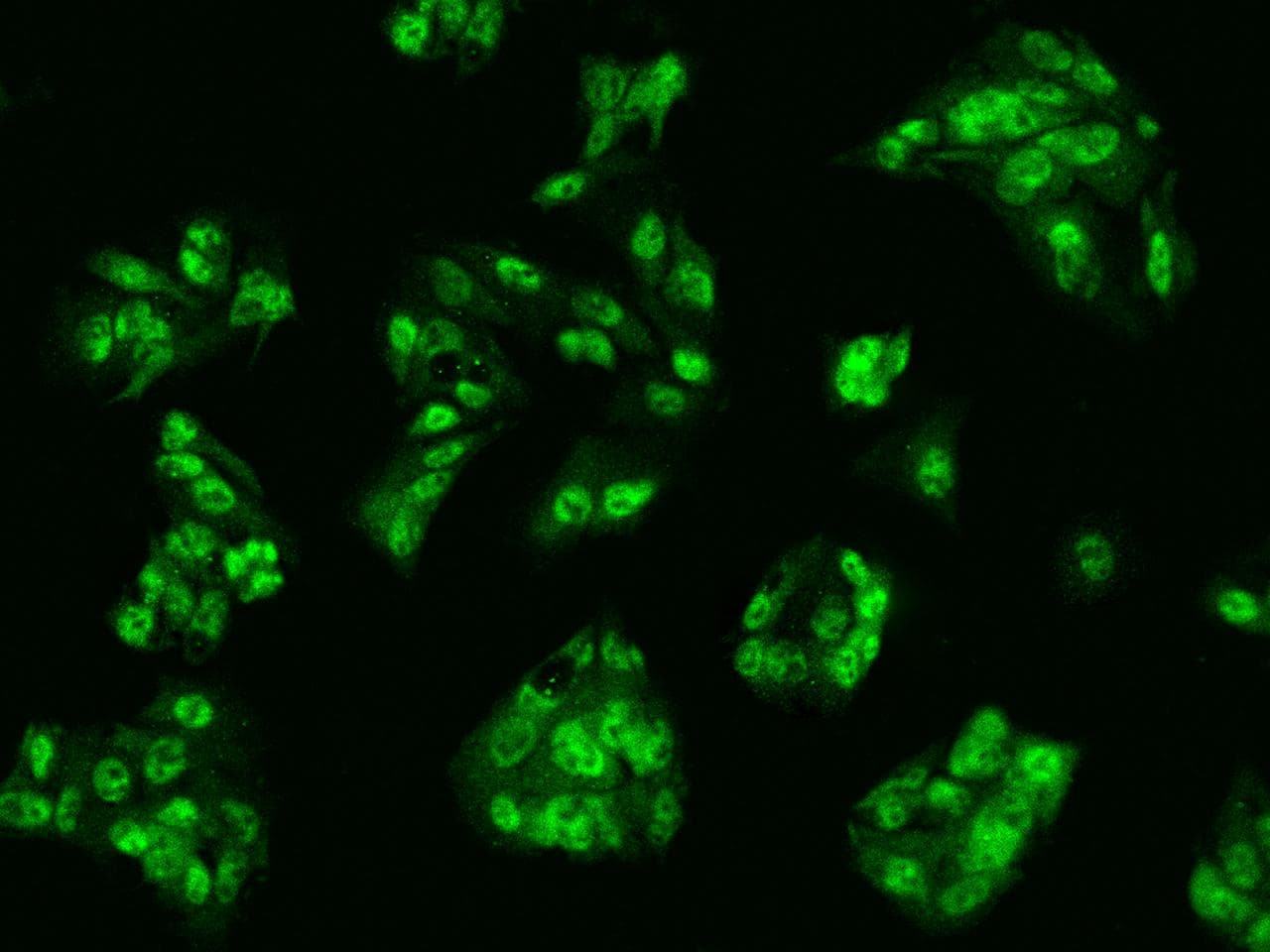 CCND2 / Cyclin D2 Antibody