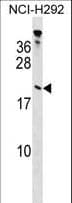 Polyclonal Rabbit anti-Human TPPP Antibody (aa47-75, WB)