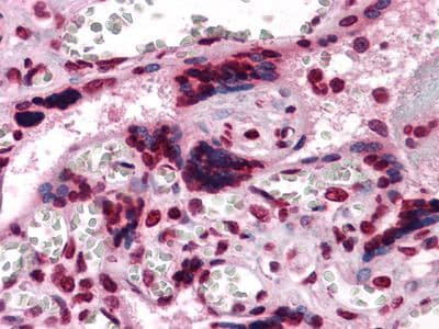 Monoclonal Mouse anti-Human CSF1 / MCSF Antibody (clone 2D10, IHC, WB)