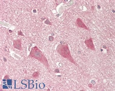 IHC-plus™ SCN8A / Nav1.6 Antibody (N-Terminus)