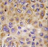 Polyclonal Rabbit anti-Human PFKFB1 Antibody (aa259-289, IHC, WB)