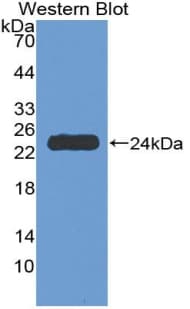TNFRSF1A / TNFR1 Antibody (aa248-428)