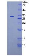 Mouse MUC16 / CA125 Protein (Recombinant His, N-Terminal)