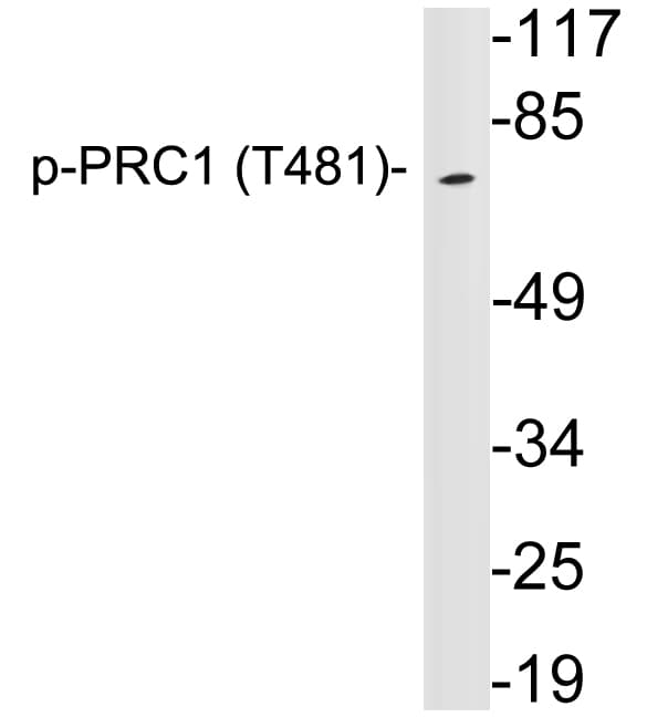 Polyclonal Rabbit anti-Human PRC1 Antibody (phospho-Thr481, WB)
