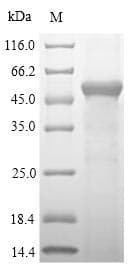 Mouse SULT1A1 / Sulfotransferase 1A1 Protein (Recombinant 10His-SUMO, N-terminus + Myc, C-terminus)