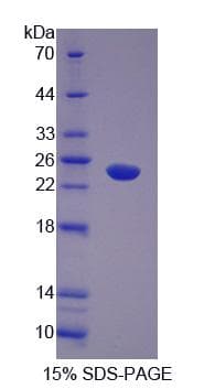 Human ABI1 / SSH3BP1 Protein (Recombinant His-S)