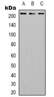 Polyclonal Rabbit anti-Human ITGB4 / Integrin Beta 4 Antibody (pY1510, IHC, WB)