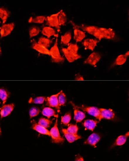 Polyclonal Rabbit anti-Human A1BG Antibody (IF)