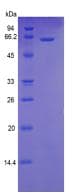 Human CD95 / FAS Protein (Recombinant His-MBP, N-terminus)