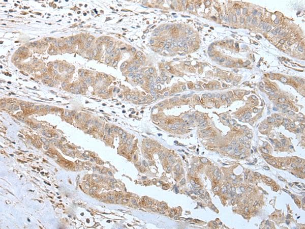 US01 / p115 Antibody
