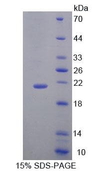 Mouse Thymidylate Kinase Protein (Recombinant His-T7, N-terminus)