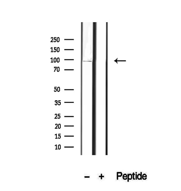 Polyclonal Rabbit anti-Human OPHN1 Antibody (IHC, IF, WB)