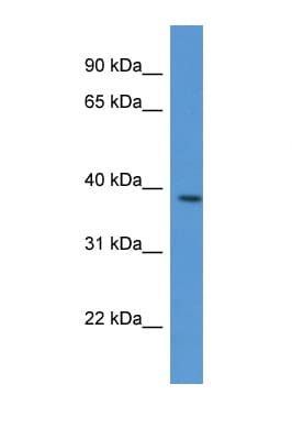 VASP Antibody (aa255-304)