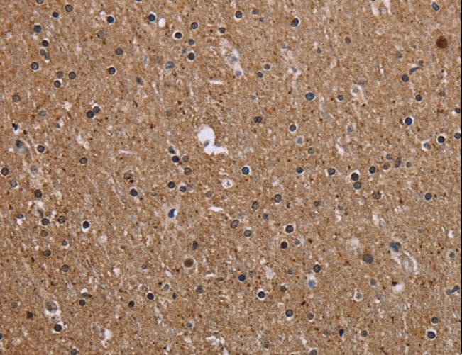 CKLFSF5 / CMTM5 Antibody