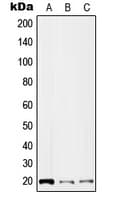 IL2 Antibody (Internal)