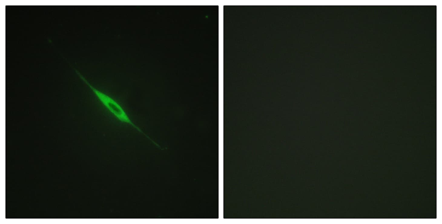 Polyclonal Rabbit anti-Human PRKCD / PKC-Delta Antibody (phospho-Tyr52, IHC, IF, WB)