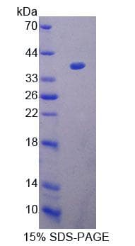 Human ACAT1 Protein (Recombinant His-T7, N-terminus)
