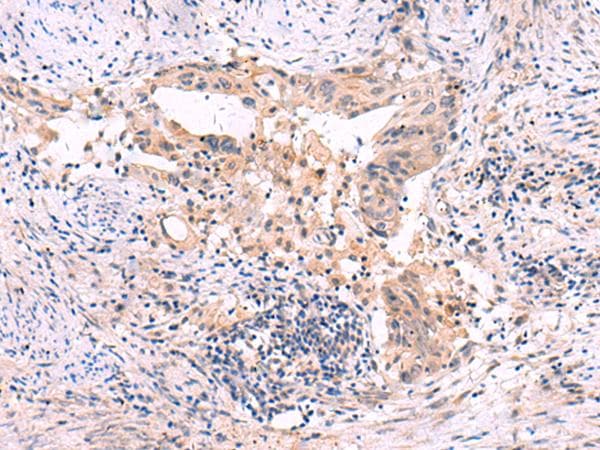 SLC12A5 / KCC2 Antibody