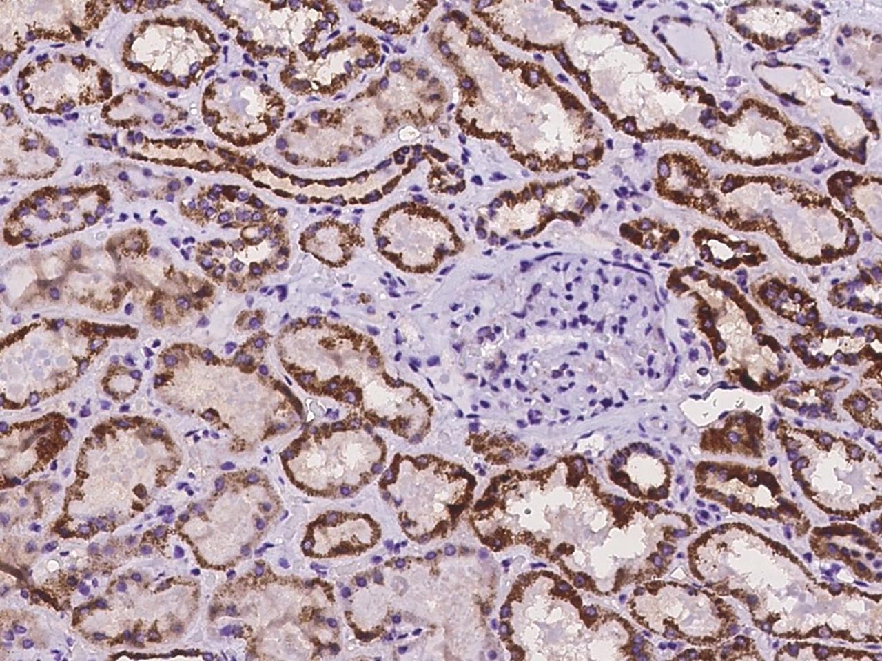ECHDC2 Antibody