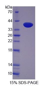 Human LASP1 Protein (Recombinant His-S)