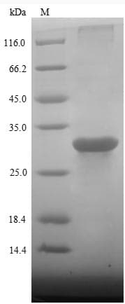 Pig Growth Hormone Receptor / GHR Protein (Recombinant 6His, C-terminus)