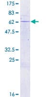 Human PEG1 / MEST Protein (Recombinant GST)