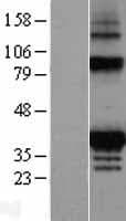 FAHD2A Protein (Over-Expression Lysate Myc-DDK (Flag))