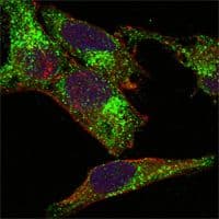 INHA / Inhibin Alpha Antibody (clone 4A2)