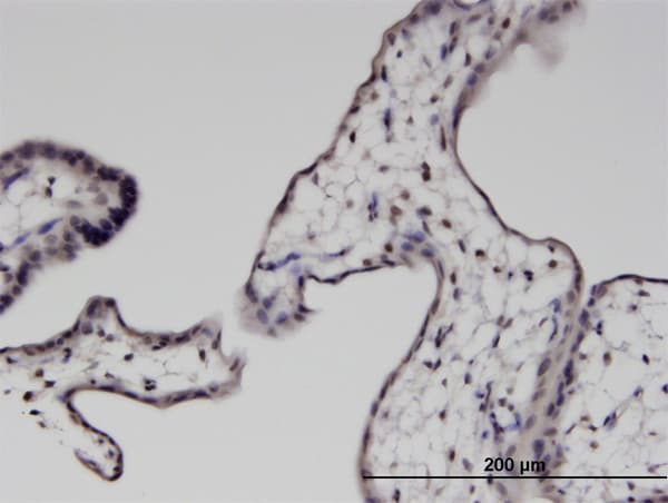 PTMS / Parathymosin Antibody (clone 2D3)