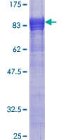 Human SNX17 Protein (Recombinant GST)