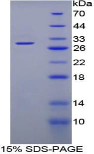 Rat CYP21A2 Protein (Recombinant His-T7)