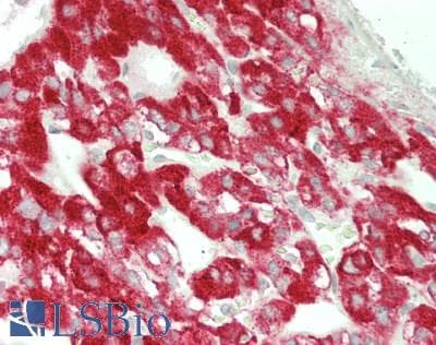 IHC-plus™ Polyclonal Rabbit anti-Human CAMKV Antibody (Internal, IHC, WB)