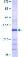 Human MTA1 Protein (Recombinant GST, N-terminus)