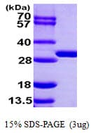 Human MCNAA / BPHL Protein (Recombinant His)