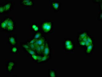 Polyclonal Rabbit anti-Human NR3C1/Glucocorticoid Receptor Antibody (IHC, IF, WB)