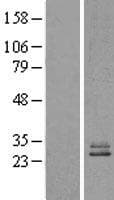 Human NDUFS3 Protein (Over-Expression Lysate Myc-DDK (Flag))